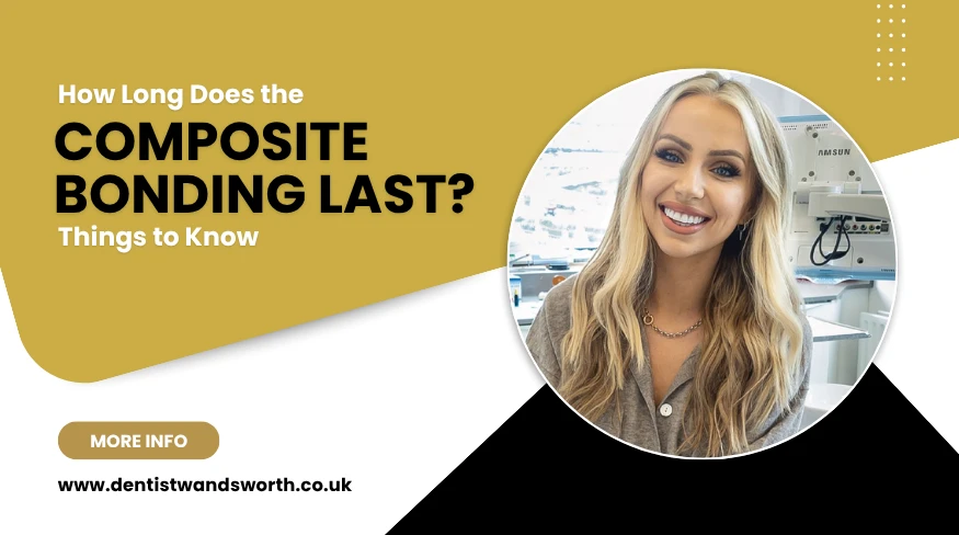 How Long Does the Composite Bonding Last? Things to Know